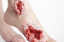 Những hình ảnh cảnh báo tác hại khủng khiếp của đường