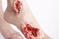 Những hình ảnh cảnh báo tác hại khủng khiếp của đường