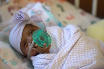 Sức sống phi thường của em bé nhỏ nhất thế giới