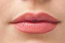 Bạn đã biết cách chăm sóc môi trong mùa hè để không thâm sạm?