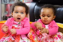 Ngắm cặp song sinh cùng trứng khác màu xa xinh xắn