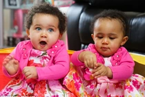 Ngắm cặp song sinh cùng trứng khác màu xa xinh xắn