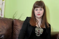 Cụt tứ chi vì nhầm viêm màng não mô cầu là cúm