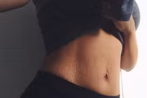 Ảnh rạn da của bà mẹ bỉm sữa gây sốt mạng