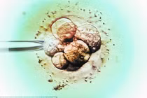 Đứa trẻ đầu tiên mang gene 3 bố mẹ sắp chào đời