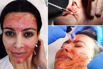 Khóc thét với đủ kiểu làm đẹp của phái nữ