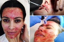 Khóc thét với đủ kiểu làm đẹp của phái nữ