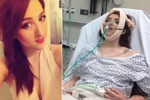 Bệnh lạ khiến thiếu nữ bị trật khớp 20 lần/ngày