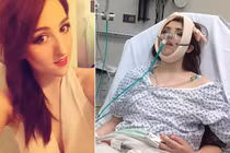 Bệnh lạ khiến thiếu nữ bị trật khớp 20 lần/ngày