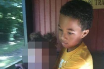 Rúng động bệnh nhi tử vong sau phẫu thuật cắt amidan