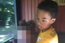 Rúng động bệnh nhi tử vong sau phẫu thuật cắt amidan