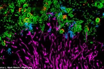 Hình ảnh kinh hoàng vi khuẩn trên mảng bám răng