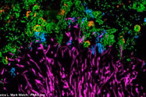 Hình ảnh kinh hoàng vi khuẩn trên mảng bám răng