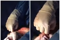 Clip bé sinh ra trong túi ối với hơi thở đầu tiên