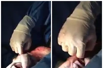 Clip bé sinh ra trong túi ối với hơi thở đầu tiên