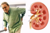 Các loại bệnh biểu hiện qua chứng đau lưng mãn tính