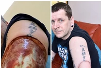 Phát hiện ung thư từ những lời cằn nhằn của vợ