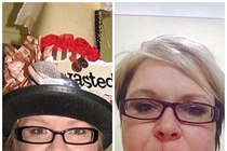 Kỳ lạ loại ung thư xúc hiếm gặp lan toàn cơ thể