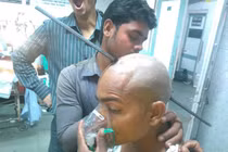 Rùng mình thanh sắt dài xuyên qua hộp sọ vẫn bình tĩnh