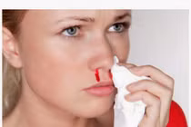 Cảnh báo 6 bệnh nguy hiểm từ chảy máu cam