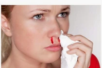 Cảnh báo 6 bệnh nguy hiểm từ chảy máu cam