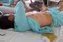 Bác đơn kiện đòi 180 triệu cắn “của quý” đại gia