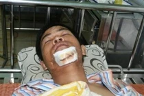 CSGT Thanh Hóa gặp nạn vì "quăng lưới" bùi nhùi