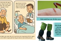 Đi rừng bị “vết cắn nhỏ” người đàn ông suýt tử vong vì nhiễm trùng huyết
