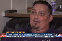 Phát hoảng khi đi nhổ 4 chiếc răng… bị mất cả hàm