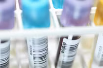 Tìm ra loại protein giảm 97% virus HIV sau 8 ngày