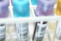 Tìm ra loại protein giảm 97% virus HIV sau 8 ngày