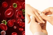 Một thứ đơn giản mà kỳ diệu không ngờ có thể chống ung thư