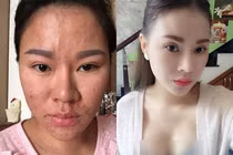 "Choáng ngất" quá trình thẩm mỹ đau đớn của bà mẹ 9x Hà Thành