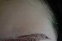 Ham làm đẹp, gái trẻ nhận thảm cảnh lông mày biến dạng