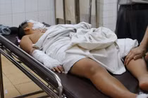 Nổ bình ga trong giờ thực hành, 5 HS tiểu học bị bỏng