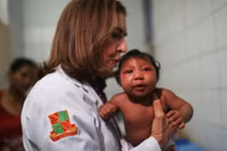 Dị tật đầu nhỏ có thể không phải do virus Zika