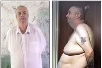 Da thừa chảy xuống tận chân sau khi giảm 70kg