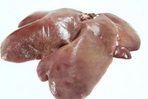 Bệnh nhân xơ gan có ăn được gan lợn không? 