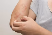 Hai bộ phận trên cơ thể bị “ngứa ngáy”, đừng lầm tưởng là dị ứng