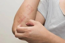 Hai bộ phận trên cơ thể bị “ngứa ngáy”, đừng lầm tưởng là dị ứng