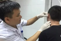 Nam sinh biến dạng “tai súp lơ” vì thích đeo khuyên cho "ngầu"