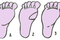 Dấu hiệu vàng trong lòng bàn chân hứa hẹn sẽ đạp trúng “kho báu” của Thần Tài