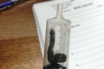 Phát hiện con vắt dài 5cm sống trong mũi người phụ nữ trong những ngày Tết