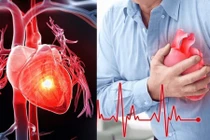 Trời lạnh, cơ thể có dấu hiệu này cần đi khám tim mạch sớm 