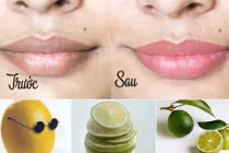 Môi hồng sau 1 đêm với 4 công thức đơn giản