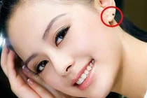 5 nốt ruồi trên mặt báo hiệu phụ nữ rất dễ trải qua "hai lần đò"