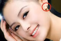 5 nốt ruồi trên mặt báo hiệu phụ nữ rất dễ trải qua "hai lần đò"