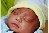 Em bé "Kangaroo" khi sinh ra chỉ to bằng bàn tay được nuôi sống 