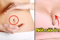 7 nốt ruồi ở chỗ kín khiến phụ nữ xấu hổ nhưng chính là quý tướng