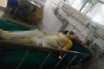 Bố đang ăn cơm bị con đổ xăng châm lửa đốt